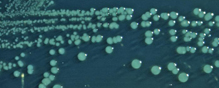 A 2000 multi-state 335-person Shigella outbreak was linked to Senor Felix 5-layer dip