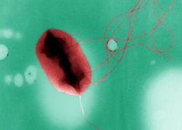 Houghton, MI E. coli Outbreak Linked to Ambassador Restaurant