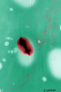 E. coli O157:H7 sources of contamination and outbreaks