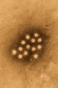 Several hepatitis A outbreaks have been traced to green onions.