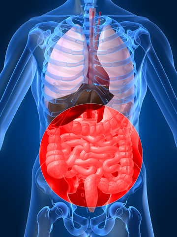 Irritable Bowel Syndrome